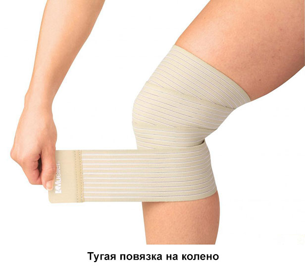 тугая повязка на колено