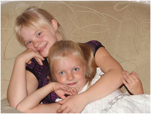 Синдром дауна и личная жизнь
