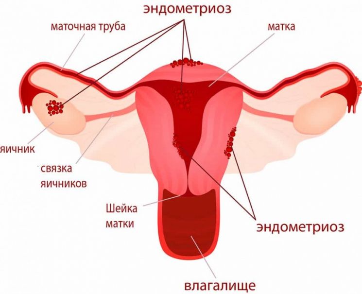 Болевой синдром при заболеваниях органов брюшной полости