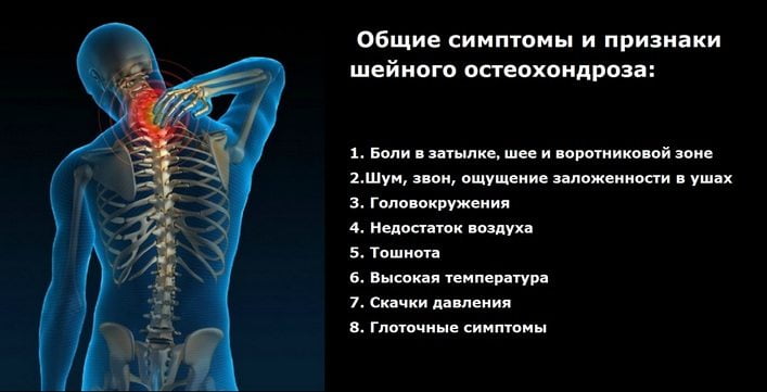 Современное лечение остеохондроза с корешковым синдромом