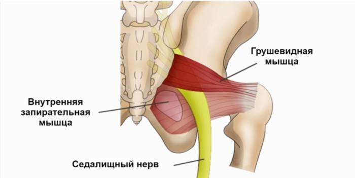 Синдром грушевидной мышцы: 10 упражнений, которые помогут Синдром грушевидной мышцы: 10 упражнений, которые помогут