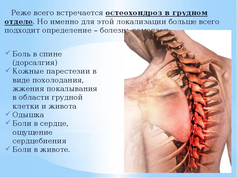 Современное лечение остеохондроза с корешковым синдромом