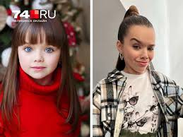 Симптоматика болезни Как проявляется синдром дауна