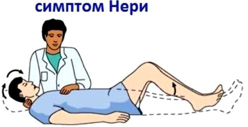 Современное лечение остеохондроза с корешковым синдромом