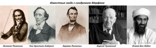 Известные люди с синдромом Марфана Известные люди с синдромом Марфана
