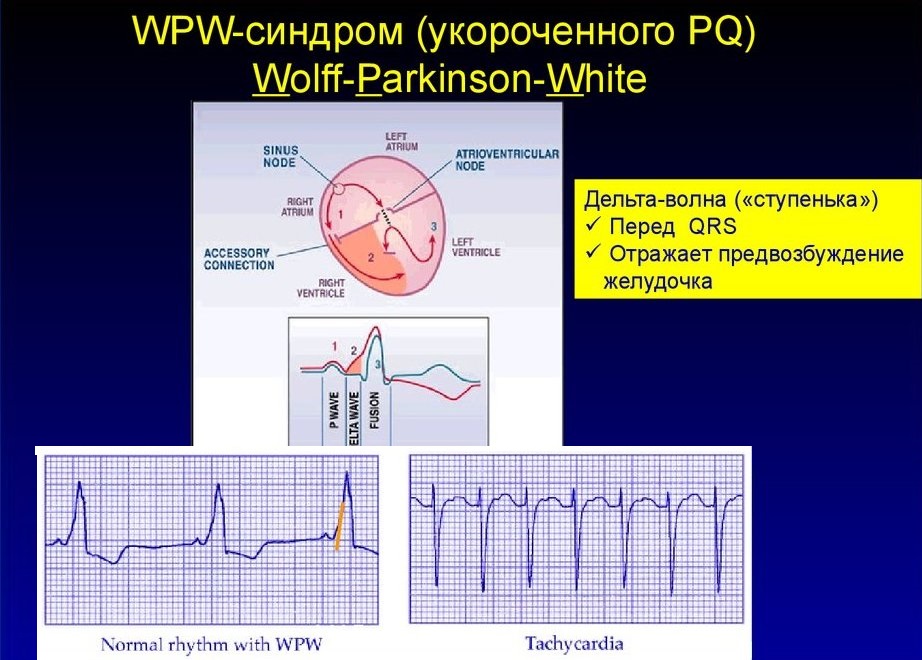 Укороченный pq код по мкб 10
