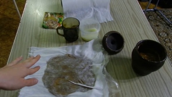 Тоннельный синдром запястного канала. Симптомы и лечение. Гимнастика, народные средства, операция