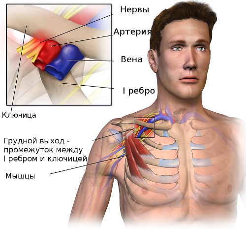 Причины развития синдрома грудного выхода Причины развития синдрома грудного выхода