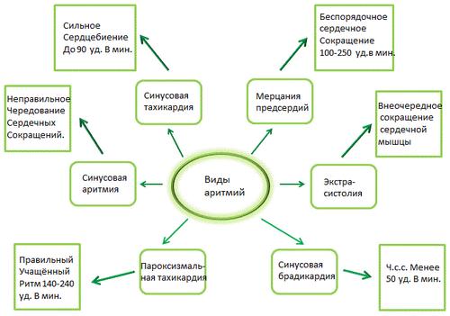 Виды аритмии Виды аритмии